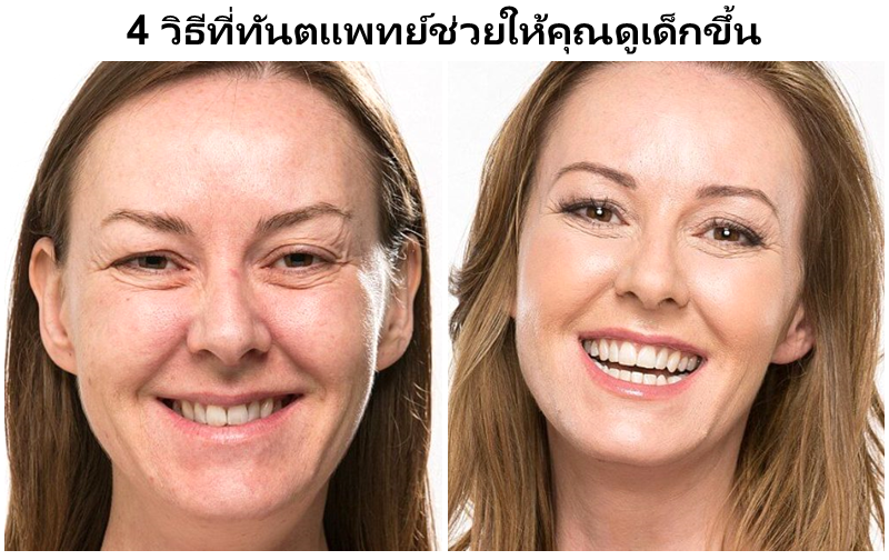 4 วิธีที่หมอฟันช่วยให้คุณเด็กลงได้